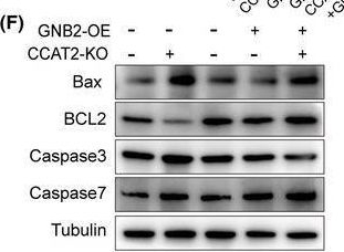 Fig.8.F showing Western Blotting in a Homo sapiens (Human) sample from the publication: LncRNA CCAT2 promotes the proliferation and metastasis of colorectal cancer through activation of the ERK and Wnt signaling pathways by regulating GNB2 expression.