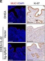 Fig.5.E from the publication: IGFBP5 Restores Endometrial Receptivity and Rescues Implantation Failure in Polycystic Ovary Syndrome.