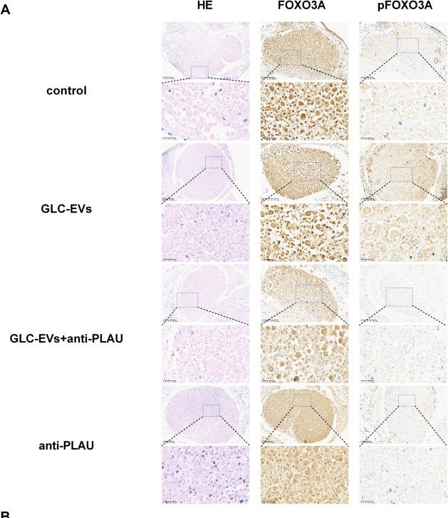 Fig.7.A showing Immunohistochemistry from the publication: Extracellular vesicles derived from differentiated granulosa-like cells restore the ovarian function of rats with premature ovarian insufficiency.