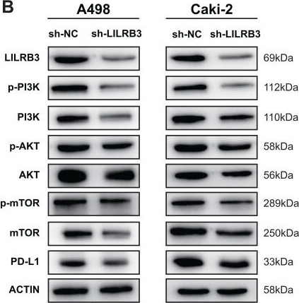 Fig.11.B showing Western Blotting from the publication: Comprehensive analysis of the leukocyte immunoglobulin-like receptor family in clear cell renal cell carcinoma.
