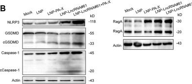 Fig.7.B showing Western Blotting in a Mus musculus (House mouse) sample from the publication: Long noncoding RNA#61 synergizes with viral PA-X to augment pyroptosis and attenuate the virulence of highly pathogenic H5N1 influenza virus in mice.