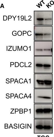 Fig.4.A showing Western Blotting from the publication: Tex46 knockout male mice are sterile secondary to sperm head malformations and failure to penetrate through the zona pellucida.