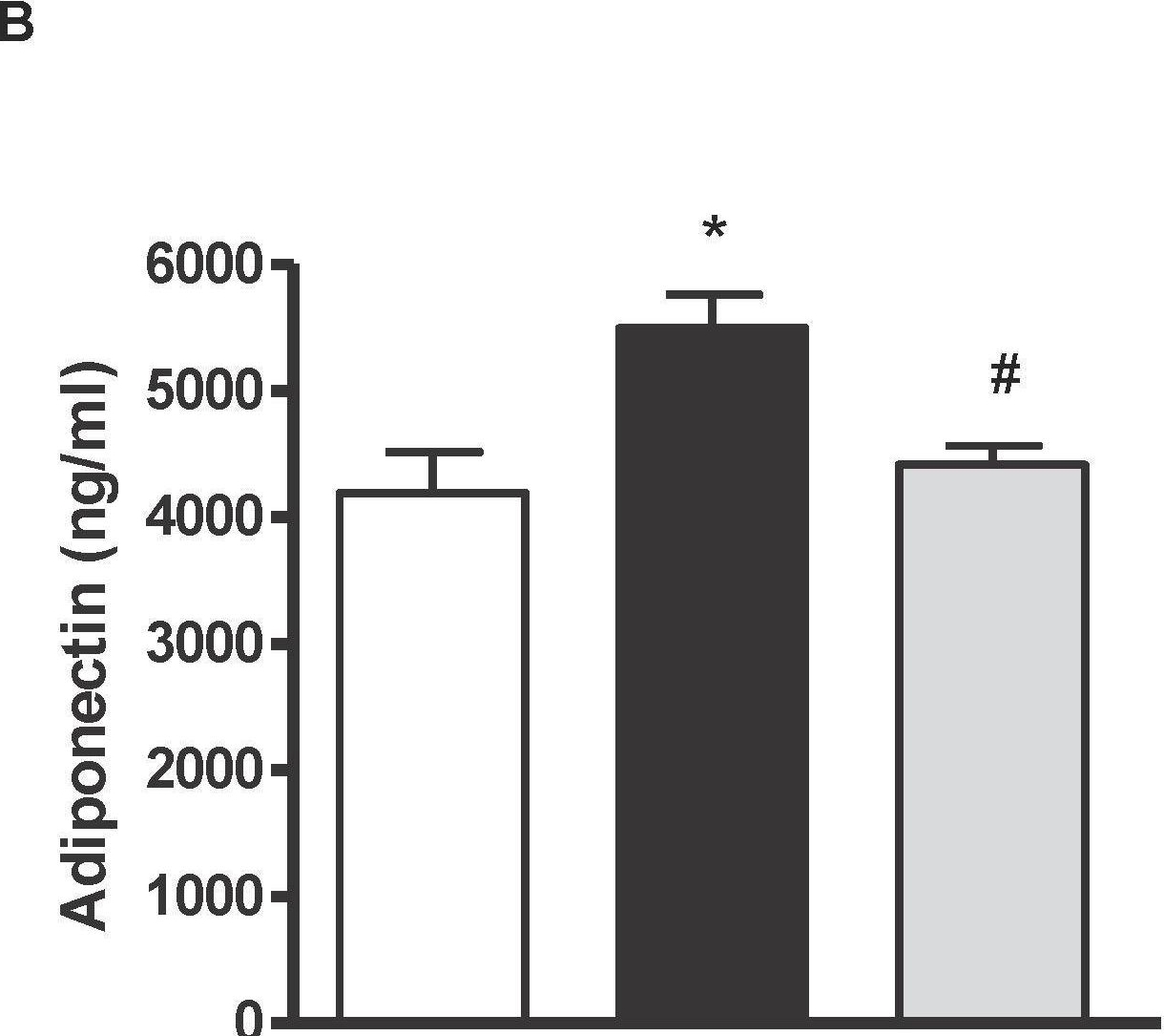 Fig.5.B showing Enzyme-linked immunosorbent assay from the publication: Pepsin Egg White Hydrolysate Ameliorates Obesity-Related Oxidative Stress, Inflammation and Steatosis in Zucker Fatty Rats.