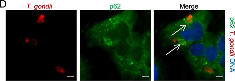 ISG15 Connects Autophagy and IFN-γ-Dependent Control of Toxoplasma gondii Infection in Human Cells.