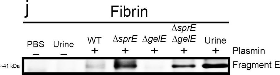 Fig.4.J showing Western Blotting in a Mus musculus (House mouse) sample from the publication: Fibrinolytic-deficiencies predispose hosts to septicemia from a catheter-associated UTI.