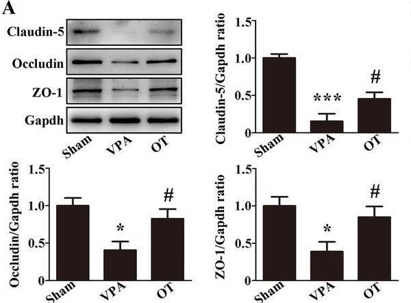 Fig.5.A showing Western Blotting from the publication: Oolong tea attenuates neuroinflammation by modulating the microbiota-gut-brain axis in a rat model of autism.
