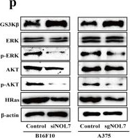Fig.1.P showing Western Blotting from the publication: NOL7 facilitates melanoma progression and metastasis.