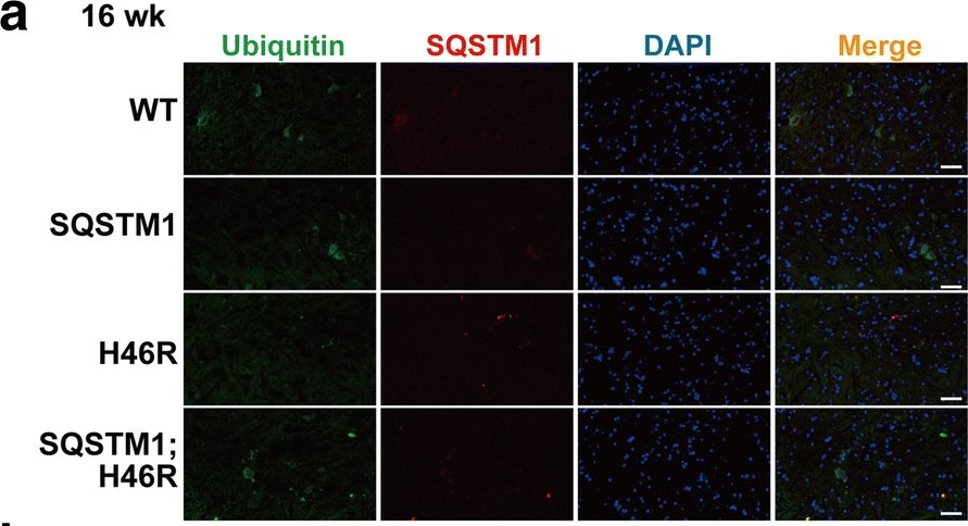 Systemic overexpression of SQSTM1/p62 accelerates disease onset in a SOD1H46R-expressing ALS mouse model.