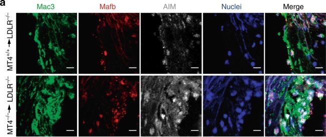 Fig.6.A showing Immunohistochemistry-immunofluorescence in a Mus musculus (House mouse) sample from the publication: MT4-MMP deficiency increases patrolling monocyte recruitment to early lesions and accelerates atherosclerosis.