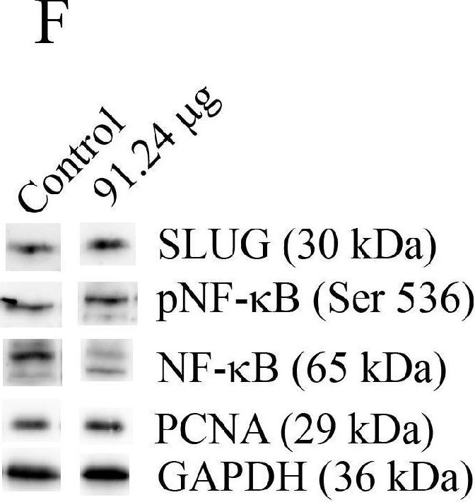 Fig.10.F showing Western Blotting in a Homo sapiens (Human) sample from the publication: Effects of Resveratrol on In Vivo Ovarian Cancer Cells Implanted on the Chorioallantoic Membrane (CAM) of a Chicken Embryo Model.