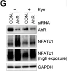 Fig.6.G showing Western Blotting from the publication: Inhibition of Human Osteoclast Differentiation by Kynurenine through the Aryl-Hydrocarbon Receptor Pathway.