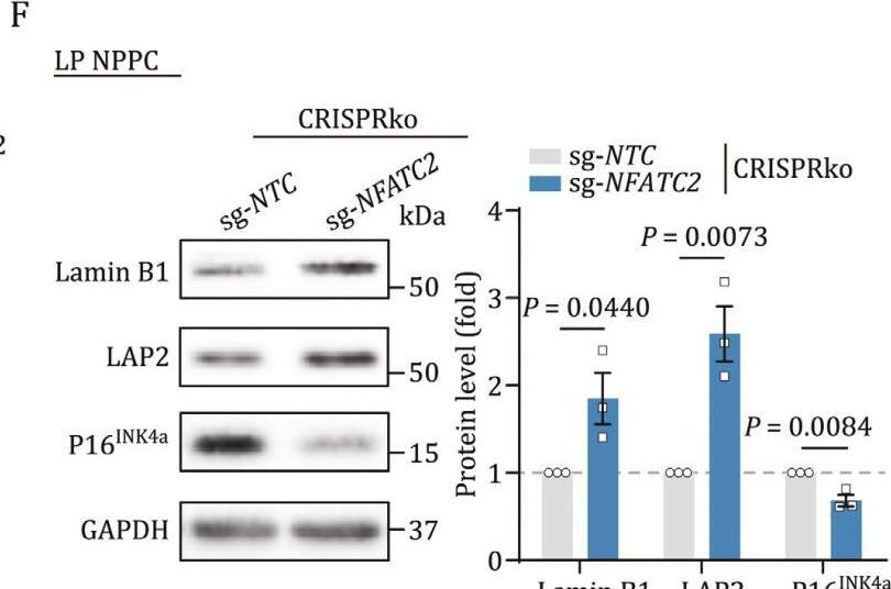 Fig.5.F showing Western Blotting from the publication: Single-nucleus transcriptomics decodes the link between aging and lumbar disc herniation.