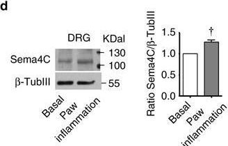 Fig.4.D showing Western Blotting in a Mus musculus (House mouse) sample from the publication: Semaphorin 4C Plexin-B2 signaling in peripheral sensory neurons is pronociceptive in a model of inflammatory pain.