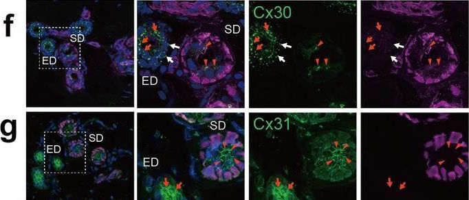 Fig.8.F showing Immunohistochemistry-immunofluorescence in a Homo sapiens (Human) sample from the publication: Gap junction-mediated contraction of myoepithelial cells induces the peristaltic transport of sweat in human eccrine glands.