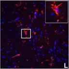 Fig.7.L showing Immunocytochemistry-immunofluorescence in a Mus musculus (House mouse) sample from the publication: IFN-gamma signaling in the central nervous system controls the course of experimental autoimmune encephalomyelitis independently of the localization and composition of inflammatory foci.