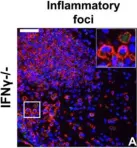 Fig.7.A showing Immunohistochemistry-immunofluorescence in a Mus musculus (House mouse) sample from the publication: IFN-gamma signaling in the central nervous system controls the course of experimental autoimmune encephalomyelitis independently of the localization and composition of inflammatory foci.