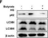 Fig.6.F showing Western Blotting from the publication: Time-Restricted Feeding Prevents Cardiac Aging by Entraining Gut Microbiota Clock and Promoting Diurnal Rhythm Autophagy in Prediabetic Mice.
