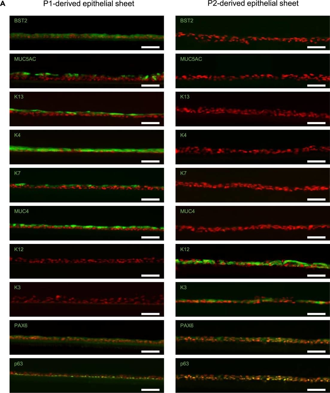 Identification of BST2 as a conjunctival epithelial stem/progenitor cell marker.