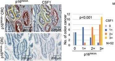 Fig.5.F showing Immunohistochemistry in a Mus musculus (House mouse) sample from the publication: Senescent Tumor Cells Build a Cytokine Shield in Colorectal Cancer.