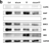 Fig.4.B showing Western Blotting from the publication: ViscumTT induces apoptosis and alters IAP expression in osteosarcoma in vitro and has synergistic action when combined with different chemotherapeutic drugs.