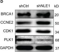 Fig.3.D showing Western Blotting from the publication: Identification of NLE1/CDK1 axis as key regulator in the development and progression of non-small cell lung cancer.