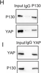 Fig.3.H showing Western Blotting from the publication: P130cas-FAK interaction is essential for YAP-mediated radioresistance of non-small cell lung cancer.