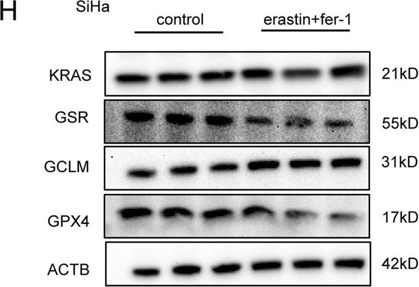 Fig.4.H showing Western Blotting in a Homo sapiens (Human) sample from the publication: Persistent ferroptosis promotes cervical squamous intraepithelial lesion development and oncogenesis by regulating KRAS expression in patients with high risk-HPV infection.