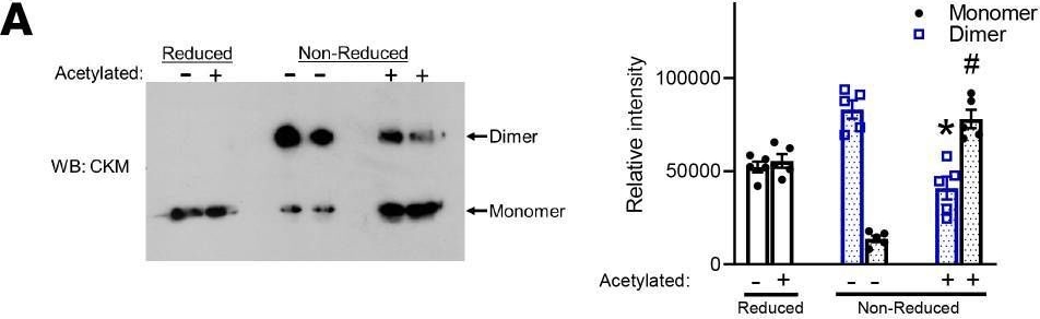 Fig.5.A showing Western Blotting in a Mus musculus (House mouse) sample from the publication: Acetylation of muscle creatine kinase negatively impacts high-energy phosphotransfer in heart failure.