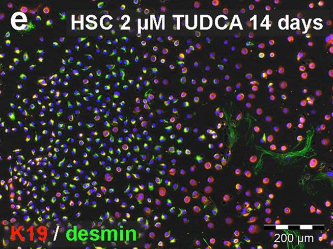 Bile acids induce hepatic differentiation of mesenchymal stem cells.