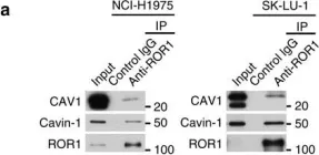 Fig.5.A showing Western Blotting in a Homo sapiens (Human) sample from the publication: ROR1 sustains caveolae and survival signalling as a scaffold of cavin-1 and caveolin-1.