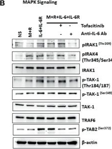 Fig.4.B showing Western Blotting in a Homo sapiens (Human) sample from the publication: Ets-2 Propagates IL-6 Trans-Signaling Mediated Osteoclast-Like Changes in Human Rheumatoid Arthritis Synovial Fibroblast.