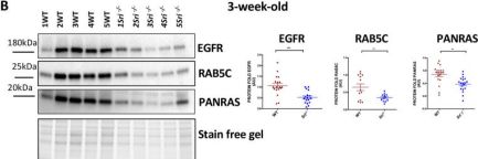 EGF Receptor (D1P9C) Rabbit Monoclonal Antibody | Cell Signaling