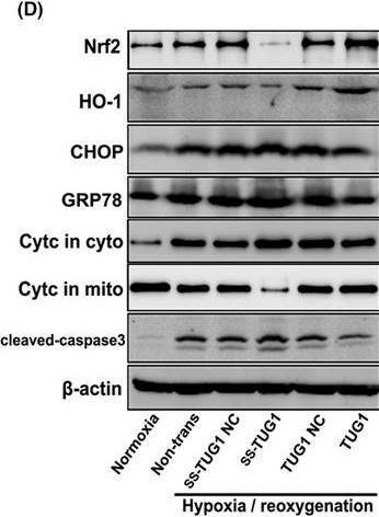 Fig.8.D showing Western Blotting from the publication: LncRNA TUG1 attenuates ischaemia-reperfusion-induced apoptosis of renal tubular epithelial cells by sponging miR-144-3p via targeting Nrf2.