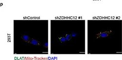 Fig.4.P showing Immunocytochemistry-immunofluorescence from the publication: Materials-Guided Gene-Ionizable Lipid Nanoparticles to Reverse Iron-Associated Immune Resistance in Renal Cancer.