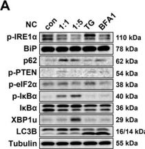 Fig.2.A showing Western Blotting from the publication: Necrotic Cells Alter IRE1α-XBP1 Signaling and Induce Transcriptional Changes in Glioblastoma.