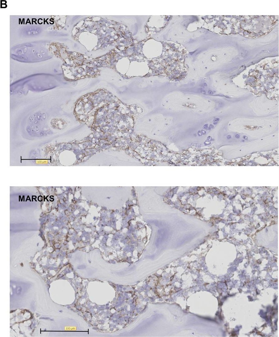 Fig.4.B showing Immunohistochemistry-paraffin-immunofluorescence in a Homo sapiens (Human) sample from the publication: Single-cell RNA sequencing of human non-hematopoietic bone marrow cells reveals a unique set of inter-species conserved biomarkers for native mesenchymal stromal cells.