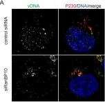 Fig.3.A showing Immunocytochemistry-immunofluorescence from the publication: A Ran-binding protein facilitates nuclear import of human papillomavirus type 16.
