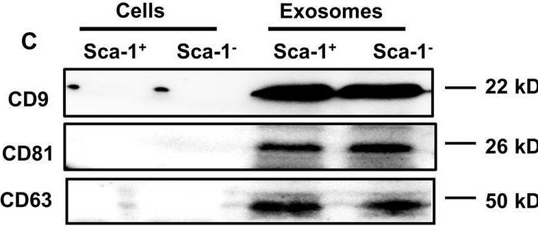 Fig.1.C showing Western Blotting from the publication: Young Sca-1+ bone marrow stem cell-derived exosomes preserve visual function via the miR-150-5p/MEKK3/JNK/c-Jun pathway to reduce M1 microglial polarization.