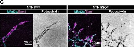 Fig.3.G showing Immunohistochemistry-immunofluorescence in a Mus musculus (House mouse) sample from the publication: Restoring compromised blood-retina-barrier integrity with Netrin-1 overexpression.