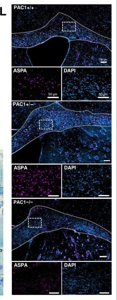 Fig.3.L showing Immunohistochemistry-immunofluorescence in a Mus musculus (House mouse) sample from the publication: PAC1 Receptor Knockout Mice Reveal Critical Links Between ER Stress, Myelin Homeostasis, and Neurodegeneration.