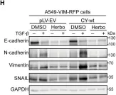 Fig.6.H showing Western Blotting from the publication: Opposing USP19 splice variants in TGF-β signaling and TGF-β-induced epithelial-mesenchymal transition of breast cancer cells.