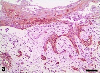 Immunohistochemical staining patterns of alpha-keratins in normal tissues from two reptile species: implications for characterization of squamous cell carcinomas.