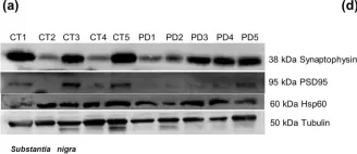 Fig.5.A showing Western Blotting from the publication: Differential protein expression in diverse brain areas of Parkinson's and Alzheimer's disease patients.