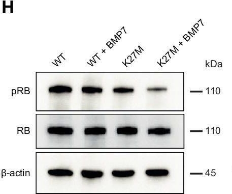 Fig.2.H showing Western Blotting in a Homo sapiens (Human) sample from the publication: BMP2 and BMP7 cooperate with H3.3K27M to promote quiescence and invasiveness in pediatric diffuse midline gliomas.