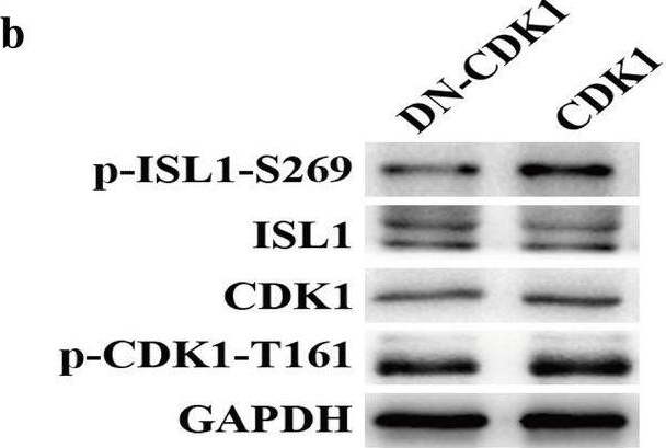 Fig.3.B showing Western Blotting from the publication: Phosphorylation of islet-1 serine 269 by CDK1 increases its transcriptional activity and promotes cell proliferation in gastric cancer.