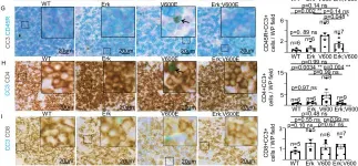 Fig.4.G showing Immunohistochemistry in a Mus musculus (House mouse) sample from the publication: Differential contribution for ERK1 and ERK2 kinases in BRAFV600E-triggered phenotypes in adult mouse models.