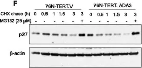 Fig.2.F showing Western Blotting in a Homo sapiens (Human) sample from the publication: ADA3 regulates normal and tumor mammary epithelial cell proliferation through c-MYC.