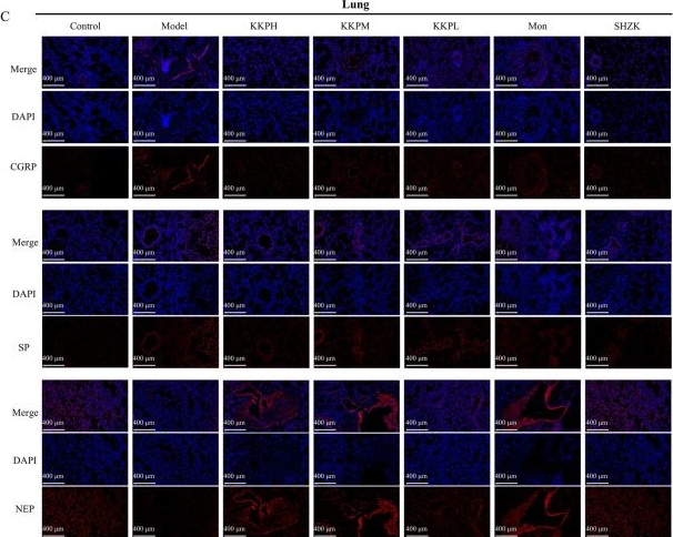 Fig.4.C showing Immunocytochemistry-immunofluorescence in a Rattus norvegicus (Rat) sample from the publication: Multi-omics and network pharmacology approaches reveal the mechanism of action of KeKe tablet against post-infectious cough.