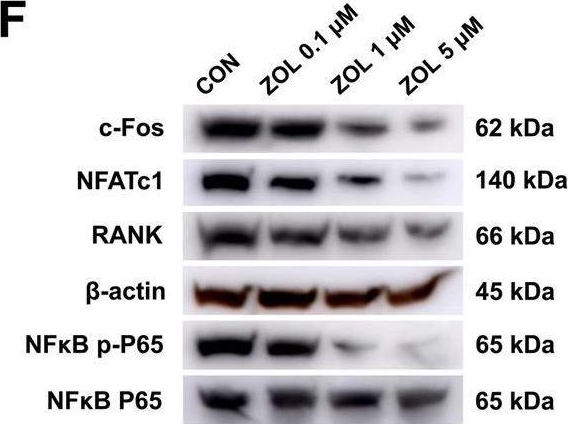 Fig.2.F showing Western Blotting in a Homo sapiens (Human) sample from the publication: Exosome-targeted delivery of METTL14 regulates NFATc1 m6A methylation levels to correct osteoclast-induced bone resorption.