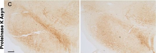 Fig.2.C showing Immunohistochemistry from the publication: Modulation of cannabinoid receptor 2 alters neuroinflammation and reduces formation of alpha-synuclein aggregates in a rat model of nigral synucleinopathy.